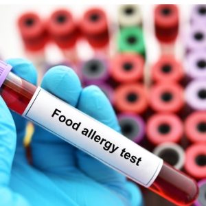 Allergy Test- Food & Environmental Testing Service