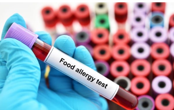 Allergy Test- Food & Environmental Testing Service